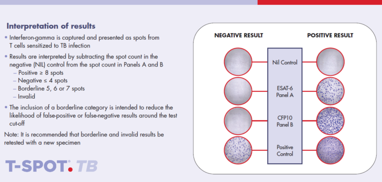 The T-SPOT.TB Test Results Interpretation - T-SPOT.TB Test For Korea